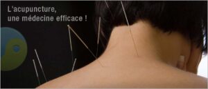Acupuncture à repentigny