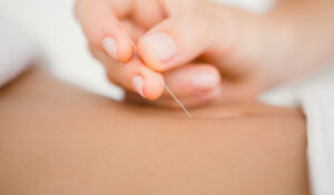 Acupuncture isabelle cyr