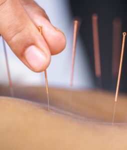 Acupuncture nicolas lefebvre