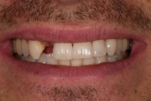 Akoya dentisterie esthétique